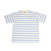 Desert Sand vs Sky Blue Zebra 2.0 – Color: Small – Size: | Buy Now at Amakipkip Store